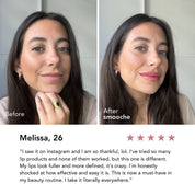 Extreme Lip Plumper