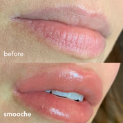 Long Lasting Lip Plumper