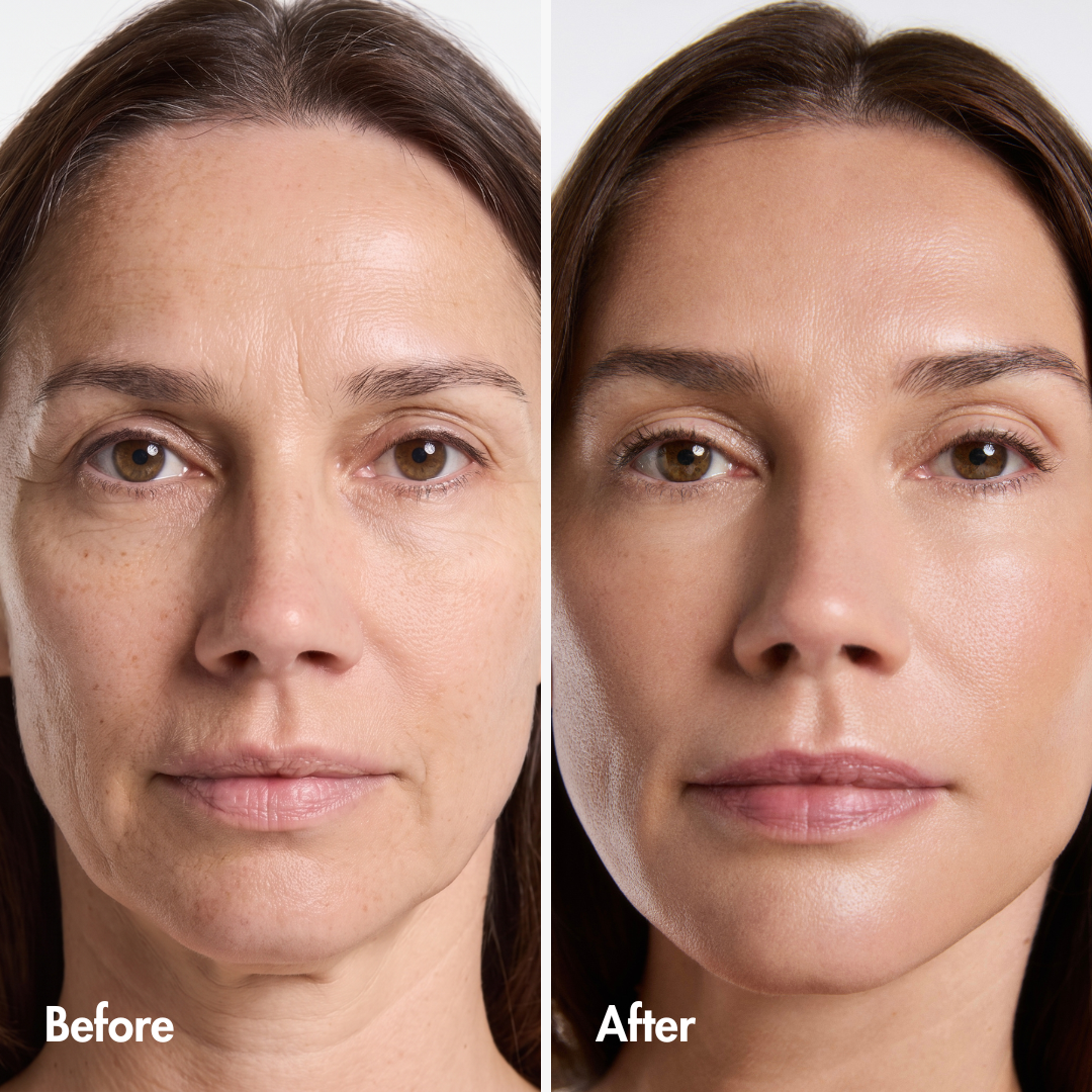 Reverse-aging Adaptive Foundation