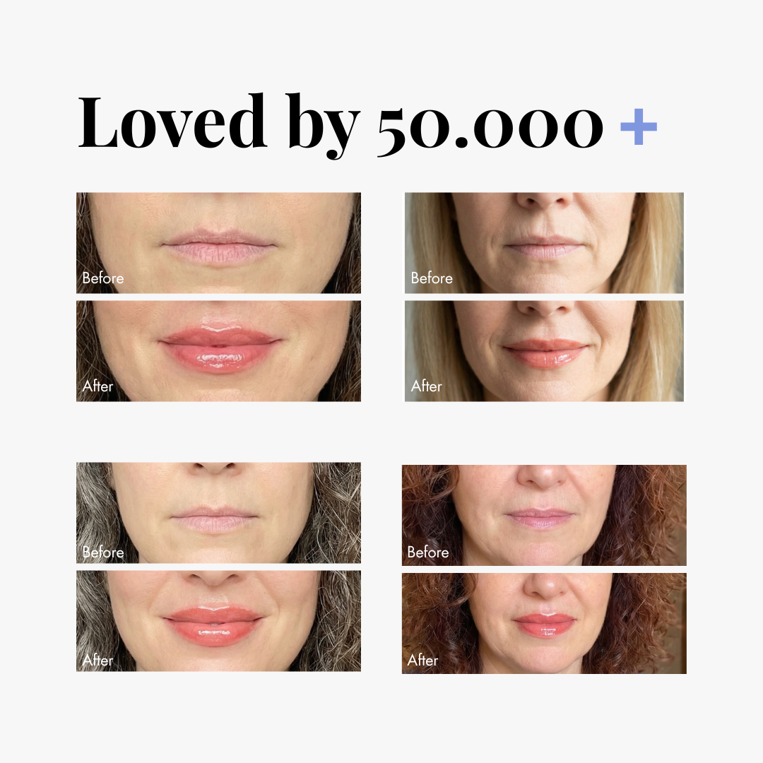 Peptide Reverse-aging Lip Plumper — lifestyle photo | Smooche