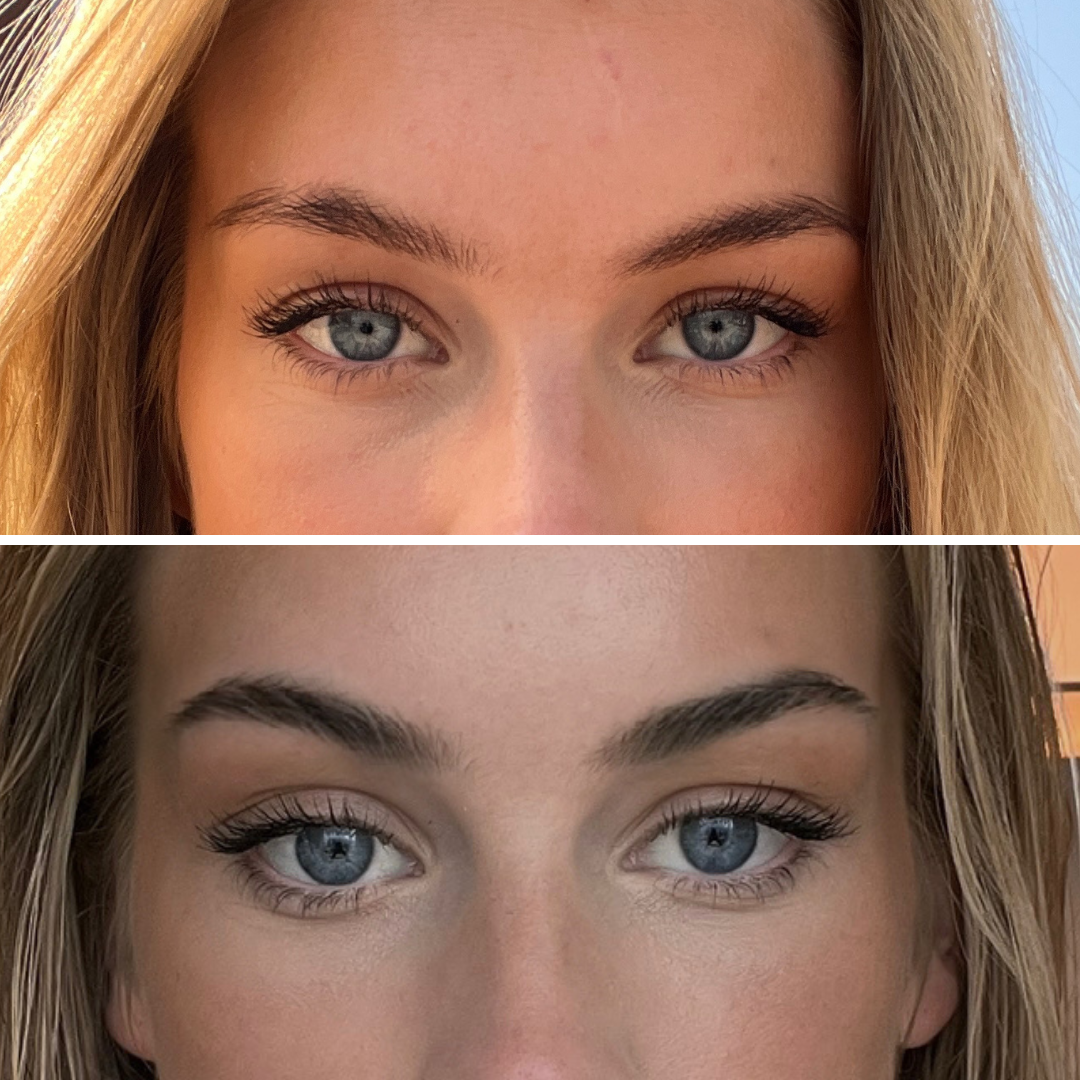 before_afters_brow_combined.png