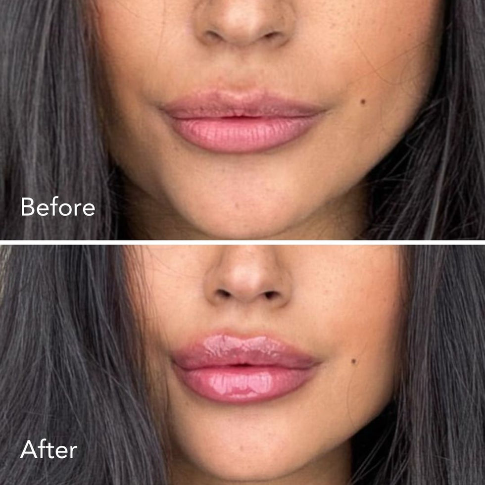 Extreme Lip Plumper Smooche