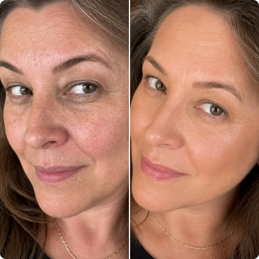 It Restores the Glow You Had in Your 30s