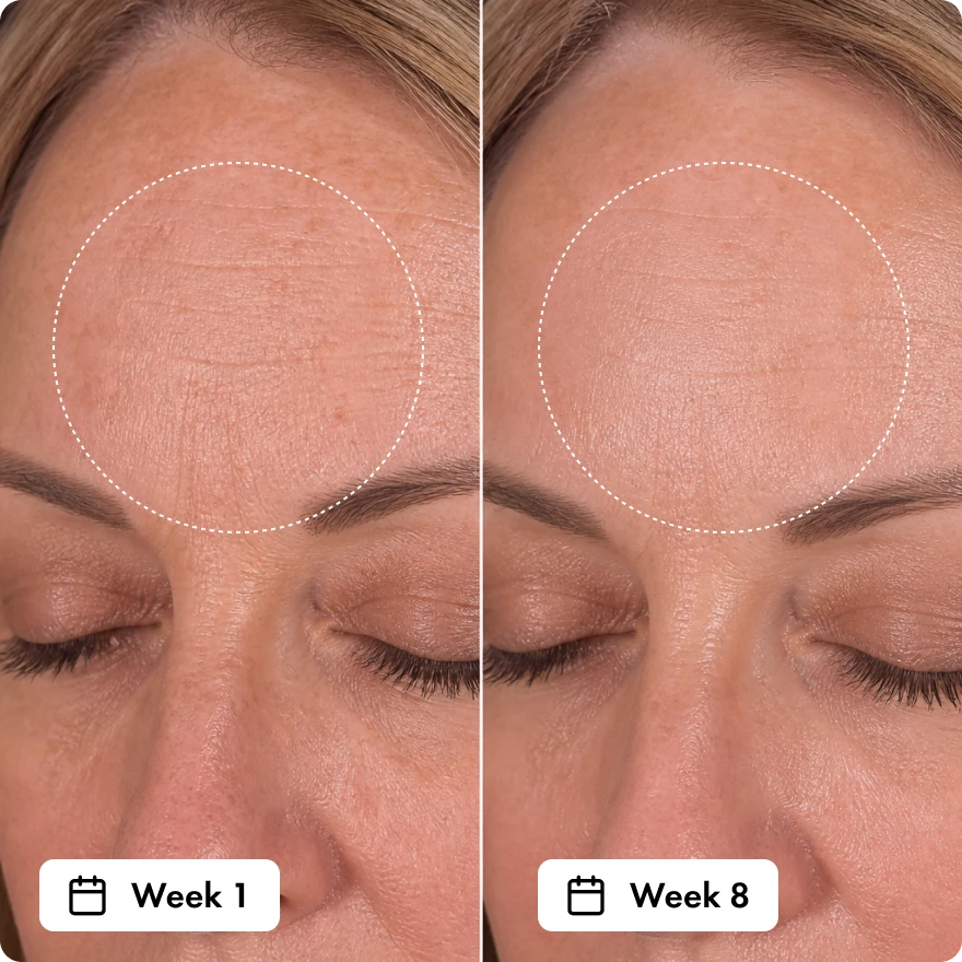 It Actually Improves Your Skin Over Time