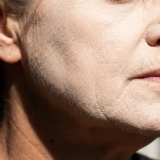 8. Es sieht aus wie Farbe, nicht wie Haut