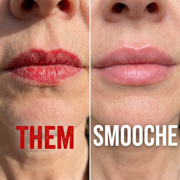 1. No More Patchy Mess