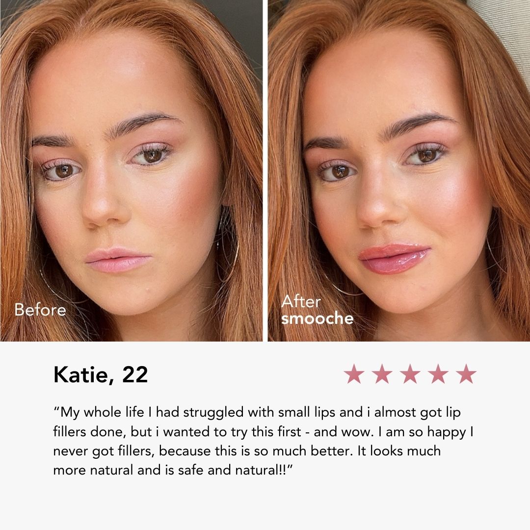 Normal Lip Plumper – Smooche